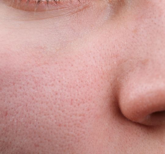 Sensitive Skin : Soothe & Calm Irritation