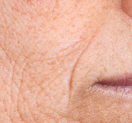 Mature Skin: Firm, Revitalise & Smooth Fine Lines