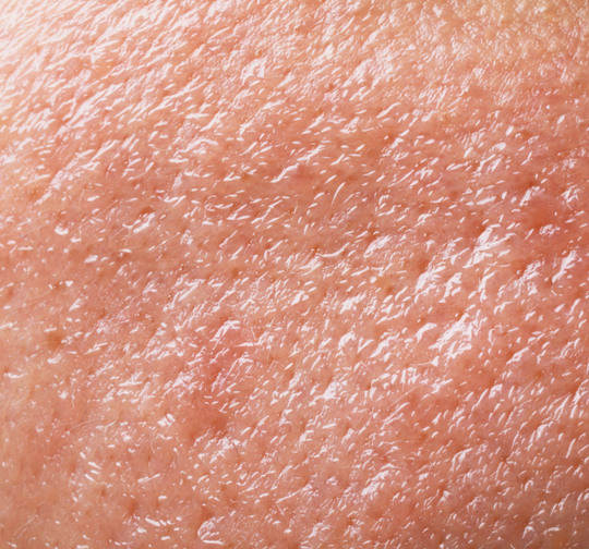 Oily Skin: Control Shine & Purify Pores